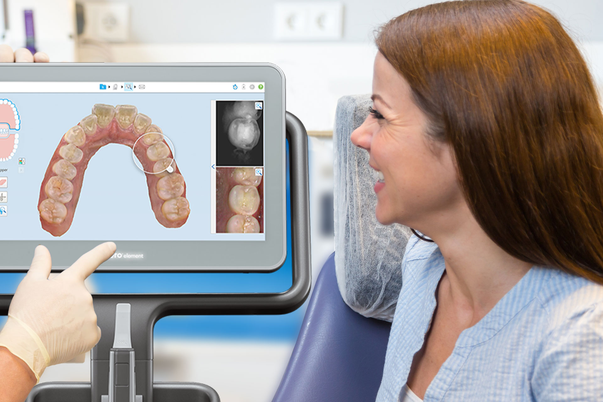 3D Scanner Scann statt Abdruck