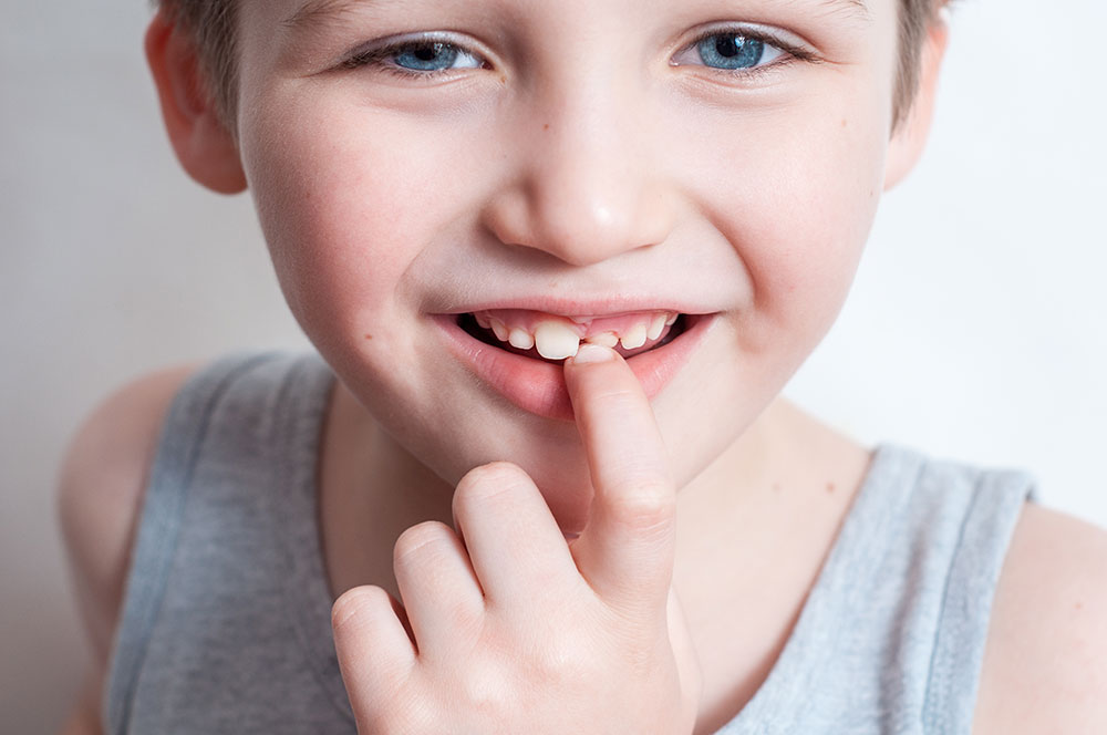 Kinder Lachen in der Kieferorthopädie Dres. Holzner