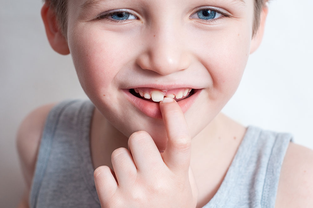 Kinder Lachen in der  Kieferorthopädie Dres. Holzner